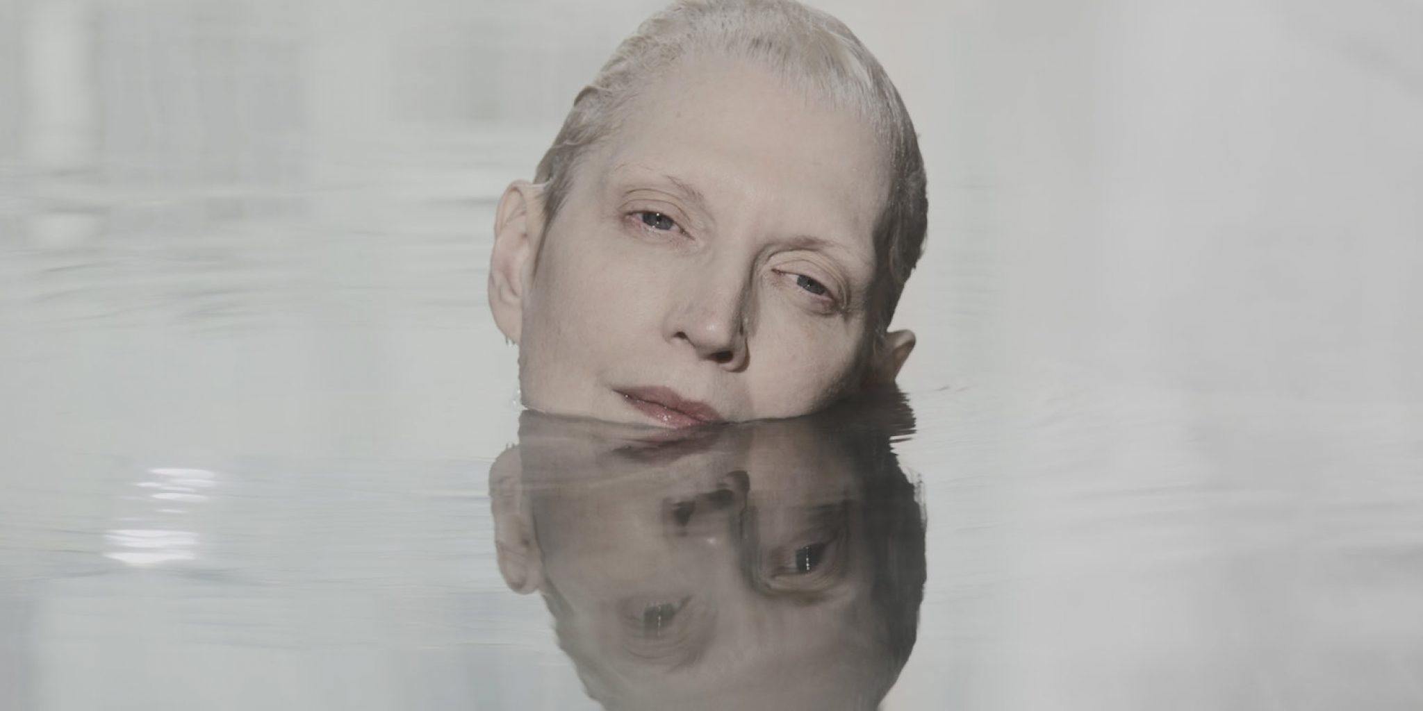 Fragile Machines, A Stirring Film That Depicts The Pain And ...