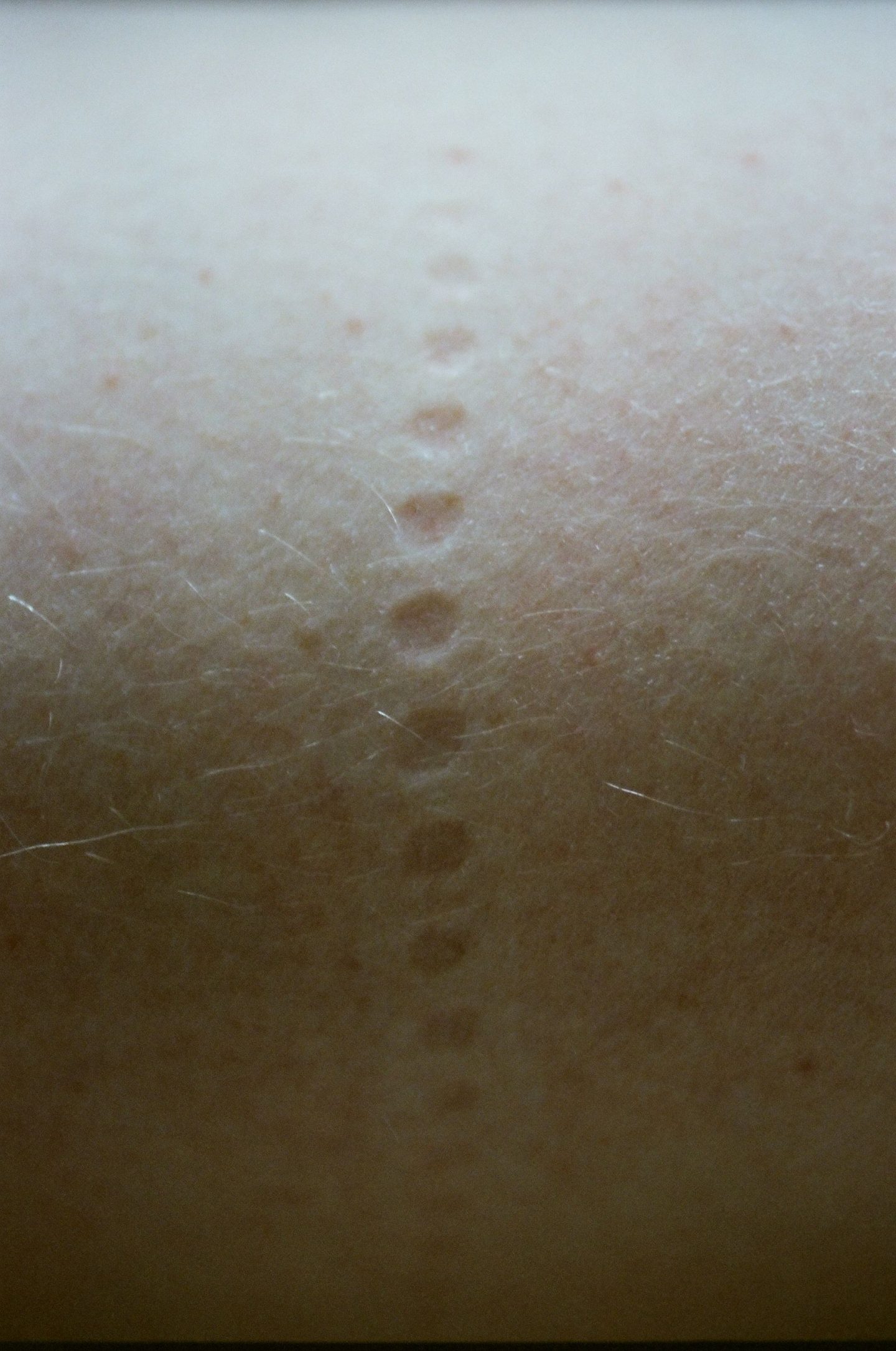 alt=“a beautiful photo of a circular dot impressions on a skin from Lina Scheynius photo - essay for Tabayer jewelry ”